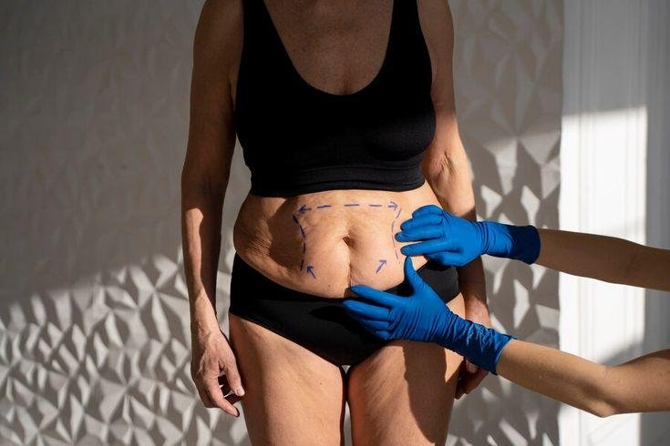 Prime Med Hub liposukcja