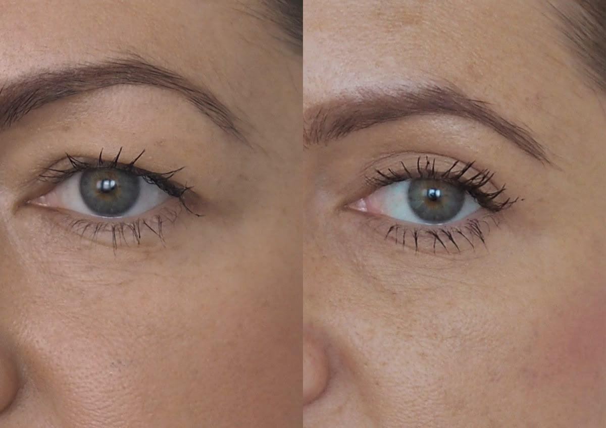 Prime Med Hub - Blefaroplastyka