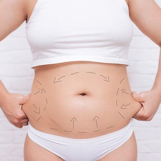 Prime Med Hub - Abdominoplastyka