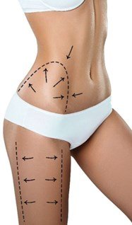 Prime Med Hub - Mommy Makeover