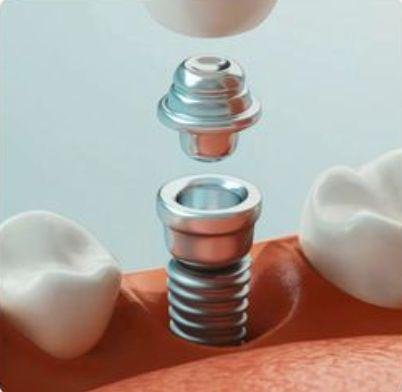 Prime Med Hub Hollywood Smile