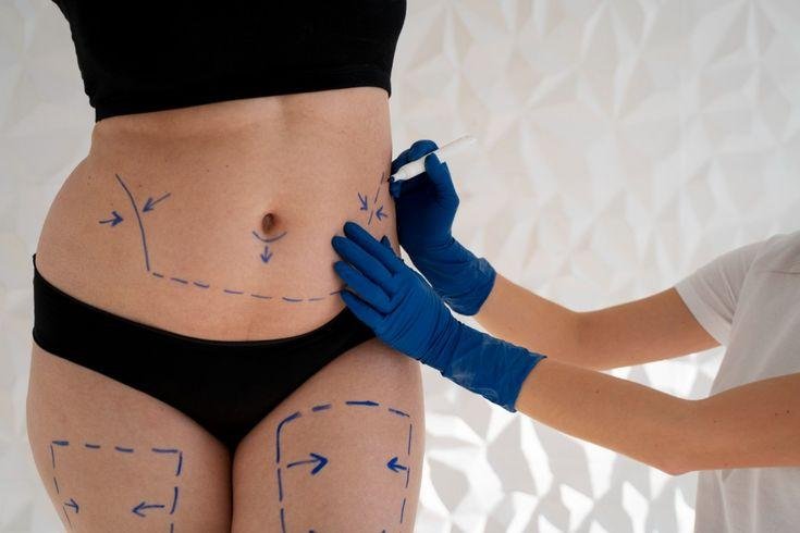 Prime Med Hub liposukcja