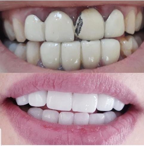 Prime Med Hub Hollywood Smile