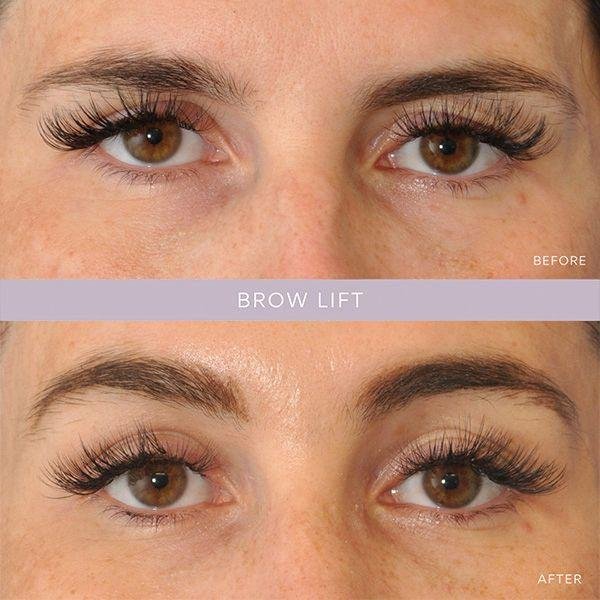 Prime Med Hub - Blefaroplastyka