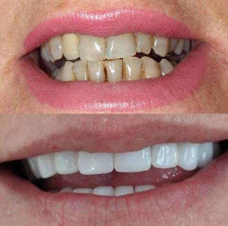 Prime Med Hub Hollywood Smile