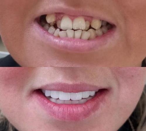 Prime Med Hub Hollywood Smile