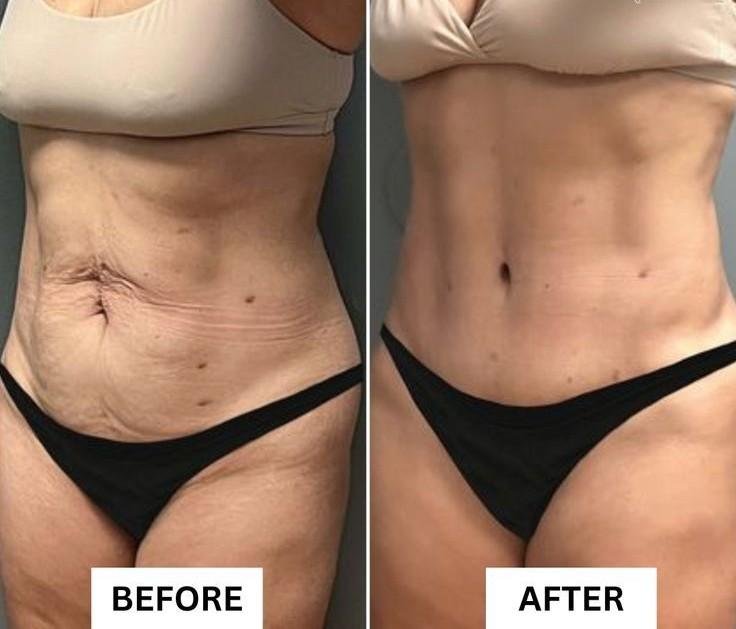 Prime Med Hub - Mommy Makeover