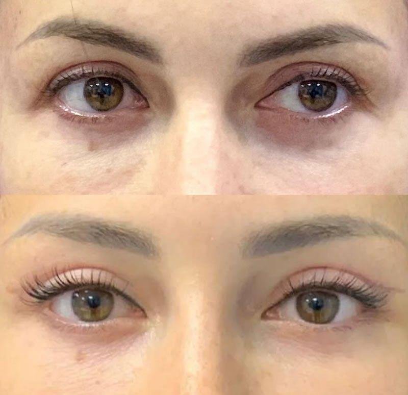 Prime Med Hub - Blefaroplastyka